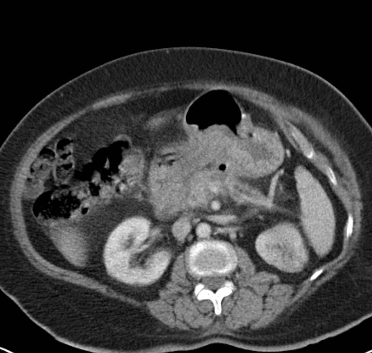 The British Society of Interventional Radiology tweet media