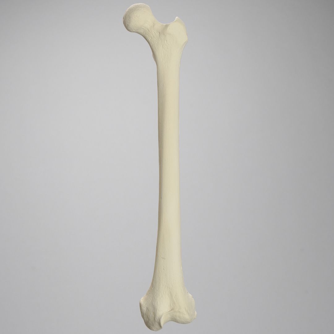 SawbonesNow's tweet photo. #Femur #bonemodel features should give residents a thorough understanding of the treatment for common #fracturepatterns seen in this area including open, oblique, comminuted, and transverse injuries.

https://t.co/1cOqZpcWZF

#orthopedics #orthopaedics #fracture #orthoTwitter https://t.co/bmxiQSvARg