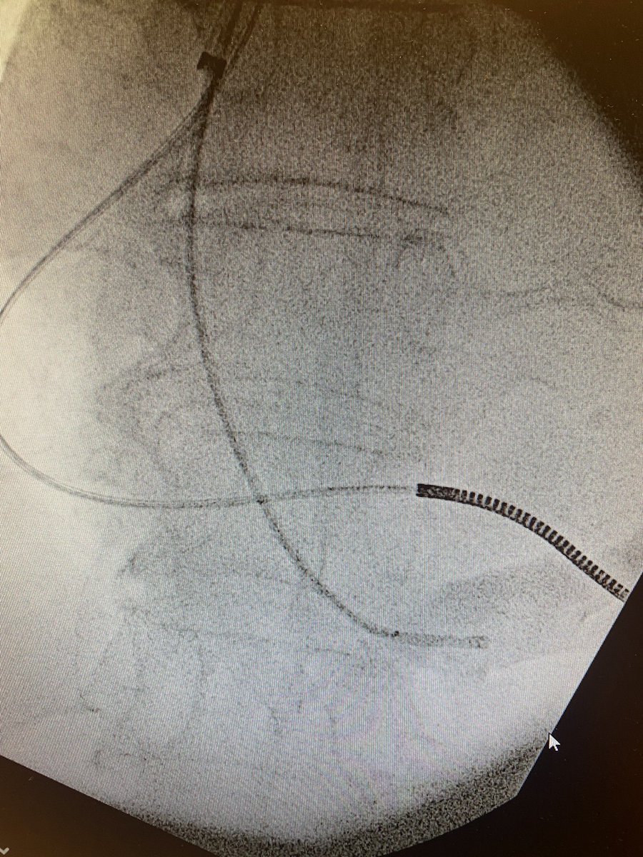 RBorgquist's tweet image. Images from the previous case