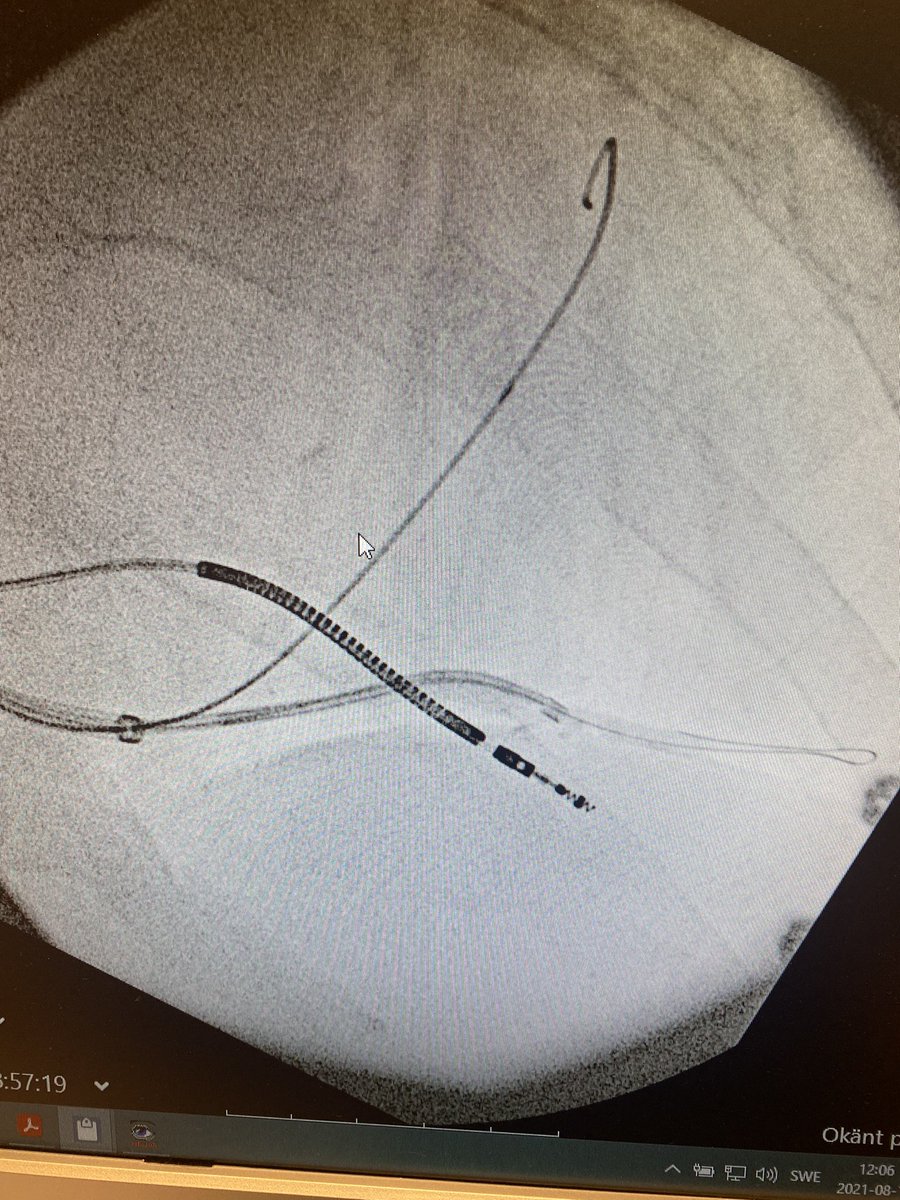 RBorgquist's tweet image. Images from the previous case