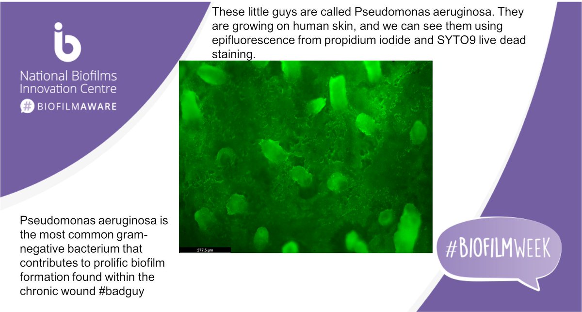 Centre for Skin Sciences - CSS (@skinbradforduni) on Twitter photo 🔎 Another brilliant image from our skin microbiome projects provided by PhD student
<a href="/PaulNor19002072/">Paul Norton</a> for #BiofilmWeek
#wound #badguy
<a href="/ukbiofilms/">National Biofilms Innovation Centre (NBIC)</a>
#biomaterials
<a href="/davidansell9/">David Ansell</a> 🔎 Another brilliant image from our skin microbiome projects provided by PhD student
<a href="/PaulNor19002072/">Paul Norton</a> for #BiofilmWeek
#wound #badguy
<a href="/ukbiofilms/">National Biofilms Innovation Centre (NBIC)</a>
#biomaterials
<a href="/davidansell9/">David Ansell</a>