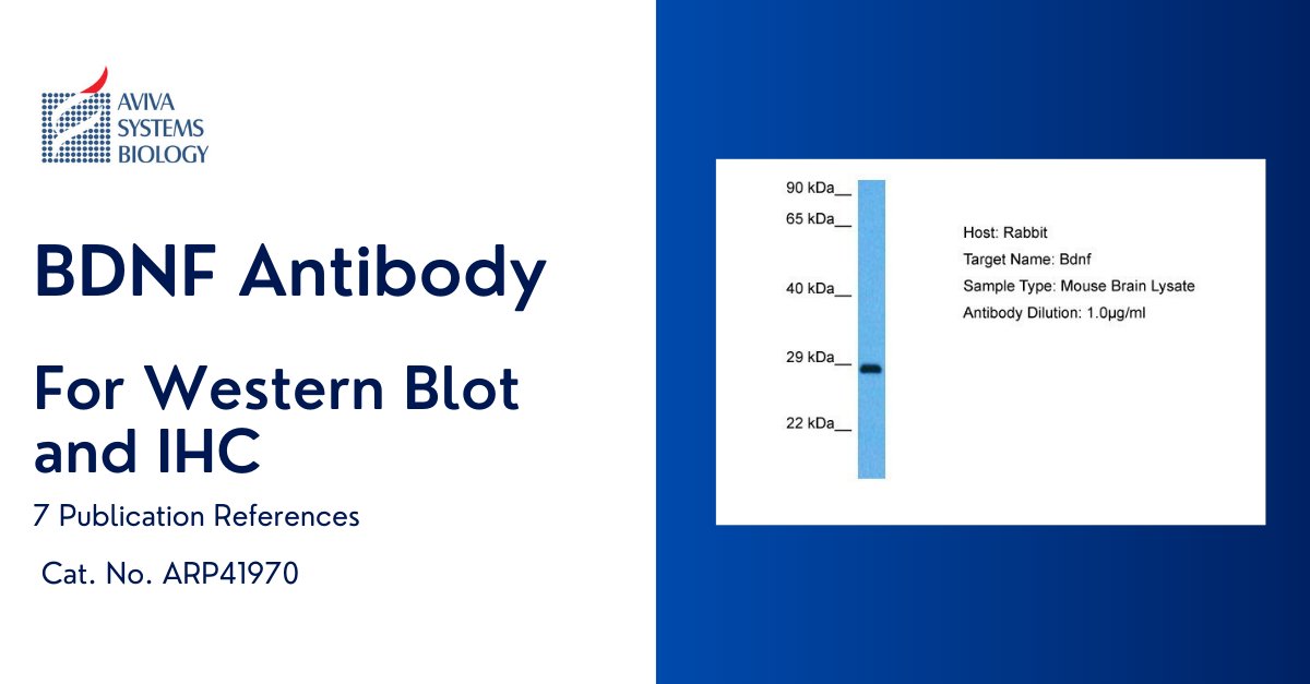 AvivaSysBio's tweet image. Referenced in 7 publications, this BDNF antibody is the antibody to consider for your #neuroscience research! avivasysbio.com/bdnf-antibody-…
Cat. No. ARP41970   #antibody #research #avivasysbio