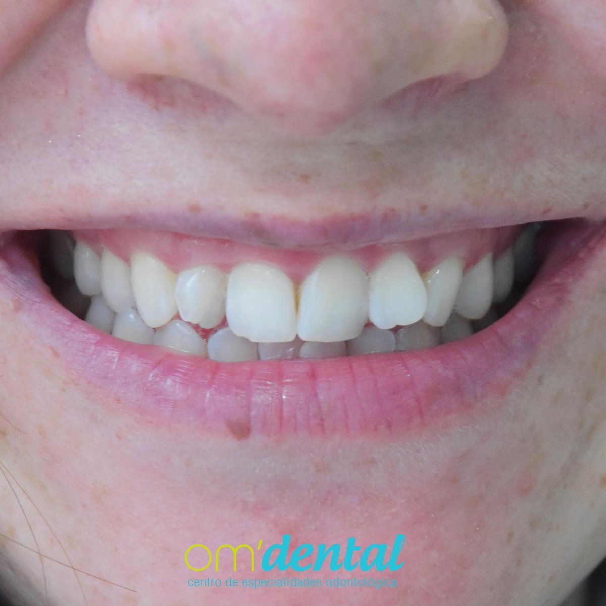 OM DENTAL EC tweet media