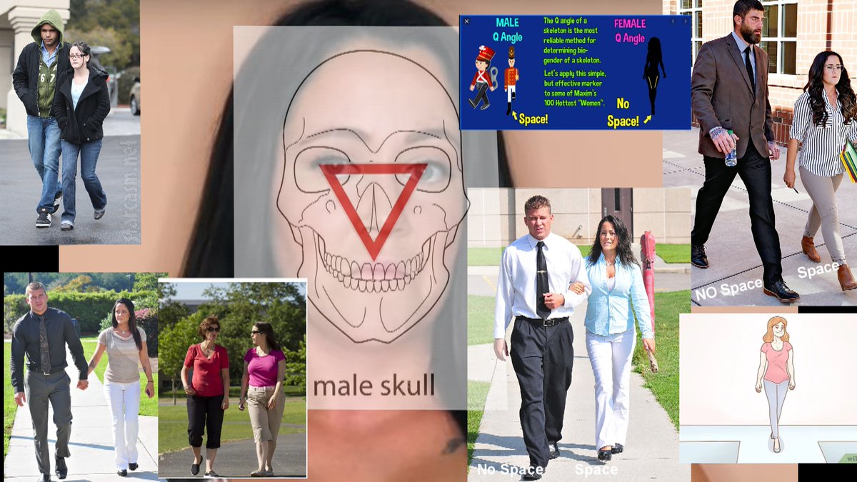 Jenelle Evans who ever HE is../main Male skull/neck/clavicles/ all the rest are gait Shots pay attention to the Knees and lead FOOT... https://t.co/r2QuRYkTk0