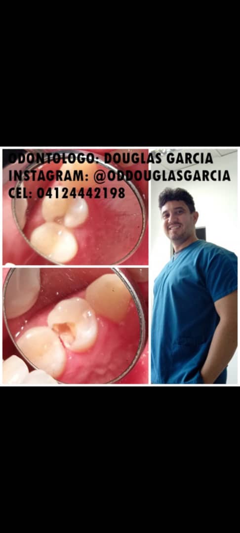 Les voy a pedir q me regalen un ret para este doctor en odontología, está en Maracay, mientras la mayoría de los odontólogos no se bajan de 50 dólares x una calza, el cobra 10 dólares y es como José Gregorio Hernández ( Medico de los pobres)☺️☺️☺️. Odontólogo d pobres. Inf👇