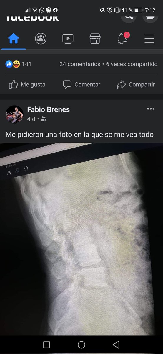 Y ese es mi viejo 😂