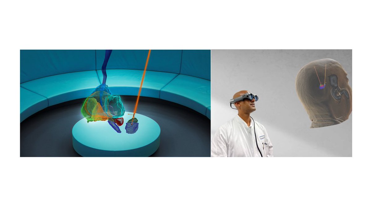 Functional Neurosurgery and Stereotaxy@FAU goes Virtual Reality in order to improve neurosurgical procedures, to perform clinical research and to provide innovative tools for medical students education