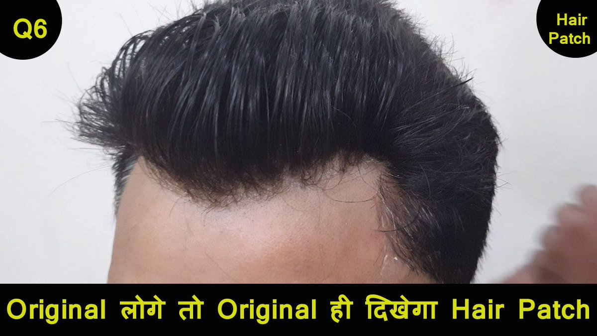 Amit Chaudhary (@delhihairphc) / Twitter Amit Chaudhary (@delhihairphc) / Twitter