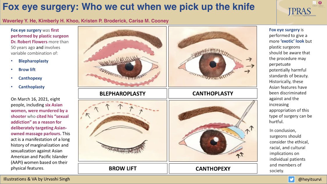 Always important to consider the ethical implications associated with cosmetic surgery.⁣
⁣
This #JPRAS paper examines the cultural implications of fox eye surgery. 👁 ⁣
⁣
Beautiful VA and illustrations from <a href="/heyitsurvi/">Urvashi Singh</a> ⁣
⁣
#plasticsurgery #cosmeticsurgery #ethics