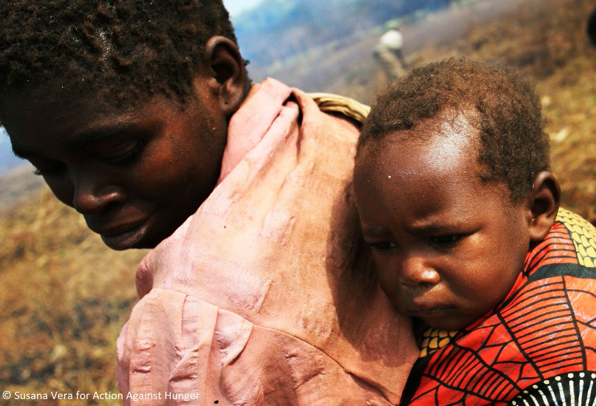 Before #COVID19, 14.3M children were suffering w/ severe acute #malnutrition globally. <a href="/UN/">United Nations</a> experts estimate that an additional 6.7M could suffer from #wasting due to the #pandemic. 

Read 5 urgent actions that can protect children’s right to #nutrition: buff.ly/3fBU3Hp