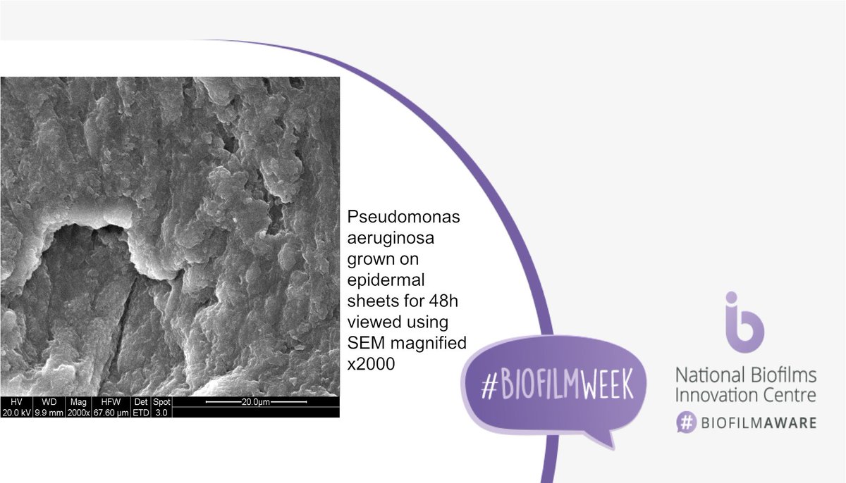Centre for Skin Sciences - CSS (@skinbradforduni) on Twitter photo 🔎We use SEM to examine biofilms grown on epidermal sheets. Biofilms are found on skin and in wounds. Microbes in biofilms are much more resistant to antibiotics. Biofilm models help us develop new antibacterials.
<a href="/PaulNor19002072/">Paul Norton</a>
#BiofilmWeek
<a href="/ukbiofilms/">National Biofilms Innovation Centre (NBIC)</a>
#wound
<a href="/davidansell9/">David Ansell</a> 🔎We use SEM to examine biofilms grown on epidermal sheets. Biofilms are found on skin and in wounds. Microbes in biofilms are much more resistant to antibiotics. Biofilm models help us develop new antibacterials.
<a href="/PaulNor19002072/">Paul Norton</a>
#BiofilmWeek
<a href="/ukbiofilms/">National Biofilms Innovation Centre (NBIC)</a>
#wound
<a href="/davidansell9/">David Ansell</a>