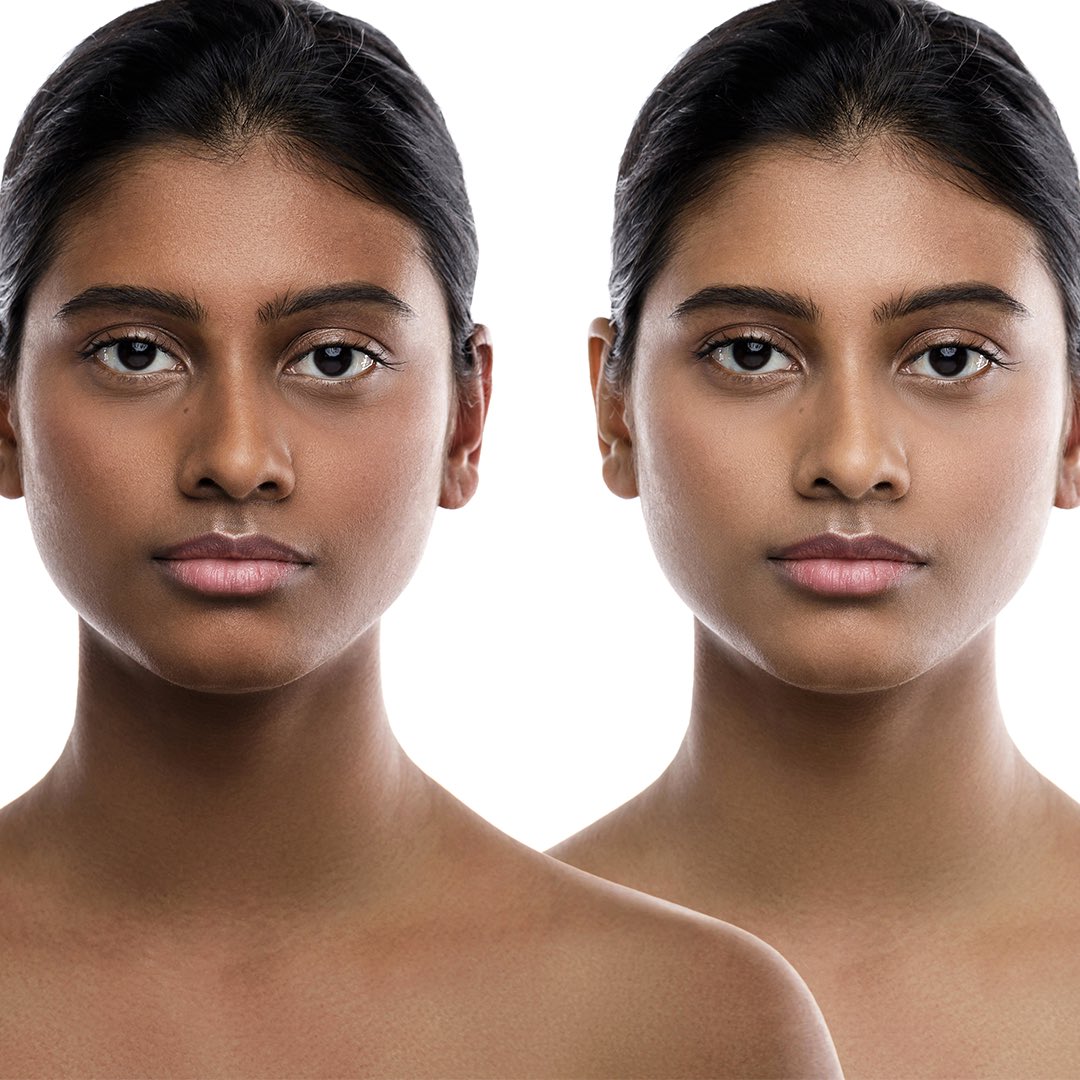 Skin Pigmentation Mechanism Confers Major Protection Against UV-Related Cancers
lnkd.in/gySCrsUc

#skin #pigmenation #melanin #darkskin #UVprotection #NNTenzyme #aminoacid #mitochondria #skincancer #Cell #MassachusettsGeneralHospital