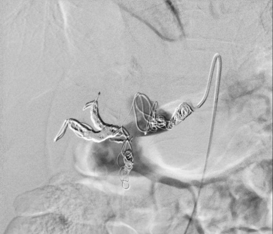 The British Society of Interventional Radiology tweet media
