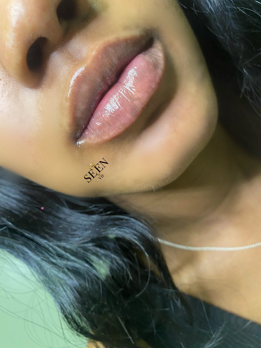 SE7ENCOSMETICS's tweet photo. Real Results 😍 https://t.co/9Obi4wj3z8