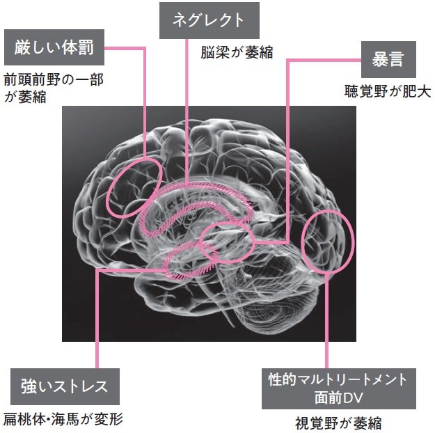 かるっち Pa Twitter 虐待に対する 防衛機制 分裂 良い 褒められる 嬉しい 自分と 悪い 叩かれる 苦しい 自分に分裂する 分離 辛い 痛い 苦しい 感情を切り離す 感情の麻痺 他人事 解離 辛い 虐待さている 自分を切り離す 記憶喪失 多重人格
