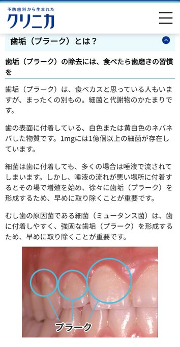 歯のクリーニングのtwitterイラスト検索結果 歯のクリーニングのtwitterイラスト検索結果
