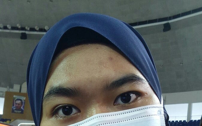 skinnshope's tweet photo. How @alluskinhq works on my skin. My skin breakout sebab product lain but Alluskin save them 😘

@draensaari @alluskinhq @alluskin_qiela https://t.co/qduGqi3CfG