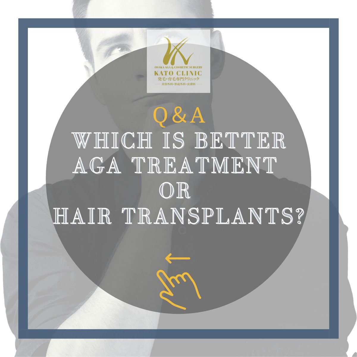 agaclinic_osaka's tweet image. As the name suggests, transplanting involves grafting one’s own hair to the area in which the hair has thinned. 👨‍⚕️#hairgrowth #thinhairproblems #alopecia #menshair
#agatreatment #hairtransplant #osakaclinic #植髮 #頭髮問題 #落髮 #掉髮 #生髮 #頭髮醫生