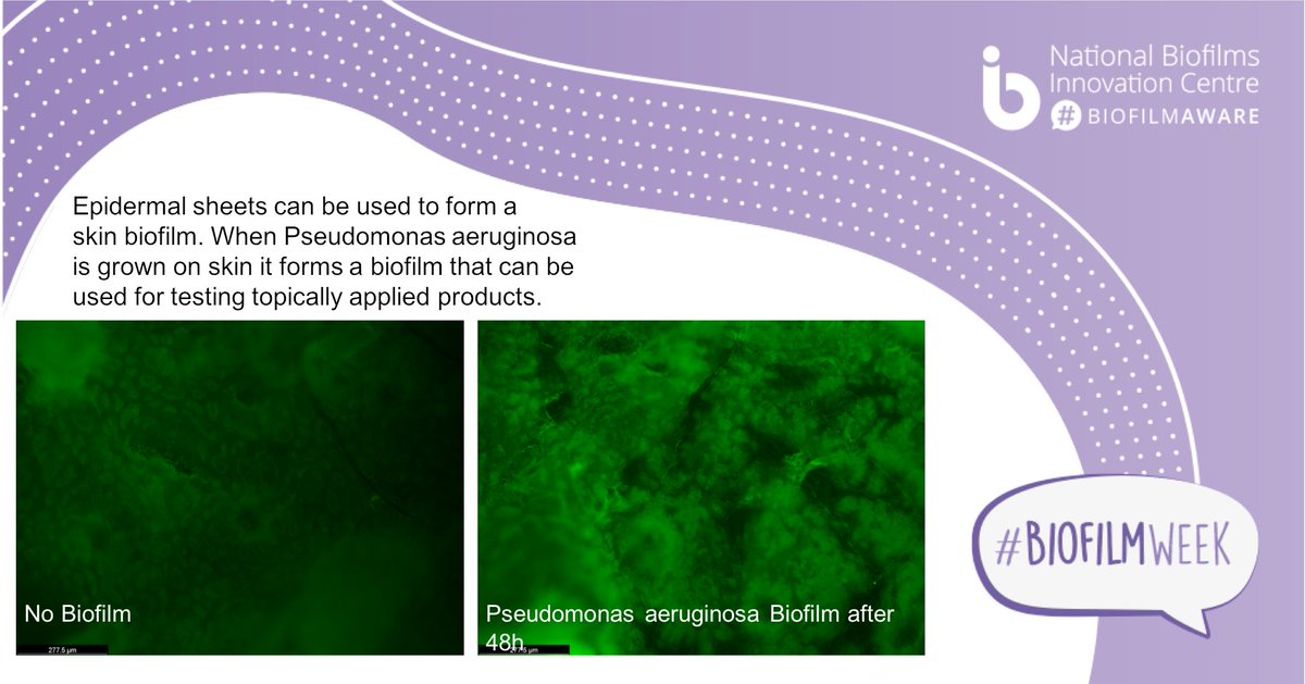 Centre for Skin Sciences - CSS (@skinbradforduni) on Twitter photo For #BiofilmWeek we have illustrated our work with #skinbiofilms thanks to <a href="/PaulNor19002072/">Paul Norton</a> who is doing his PhD <a href="/SkinBradfordUni/">Centre for Skin Sciences - CSS</a>
🔎final image shows how we visualise skin surface with and without a biofilm
<a href="/ukbiofilms/">National Biofilms Innovation Centre (NBIC)</a> <a href="/21MJulieT/">Prof Julie Thornton 💙</a> <a href="/DavidAnsell9/">David Ansell</a> For #BiofilmWeek we have illustrated our work with #skinbiofilms thanks to <a href="/PaulNor19002072/">Paul Norton</a> who is doing his PhD <a href="/SkinBradfordUni/">Centre for Skin Sciences - CSS</a>
🔎final image shows how we visualise skin surface with and without a biofilm
<a href="/ukbiofilms/">National Biofilms Innovation Centre (NBIC)</a> <a href="/21MJulieT/">Prof Julie Thornton 💙</a> <a href="/DavidAnsell9/">David Ansell</a>
