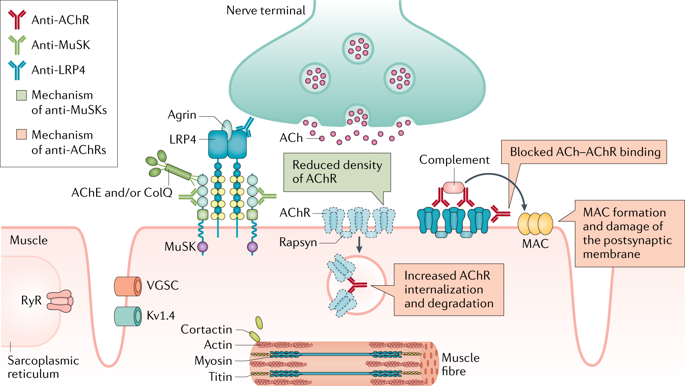 DiseasePrimers's tweet photo. #MyastheniaGravis is an #autoimmune disease caused by antibodies against the acetylcholine receptor (AChR), muscle-specific kinase or other AChR-related proteins in the #postsynaptic muscle membrane https://t.co/NCZh7B8Yi7 https://t.co/CpYStbqAbi