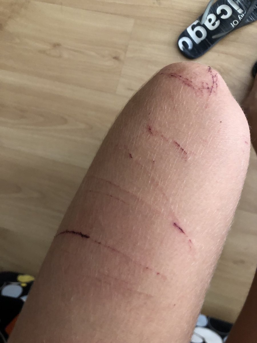 aineeetaa's tweet photo. salgo de fiesta

automáticamente mis piernas: https://t.co/DrlP9VJv6S
