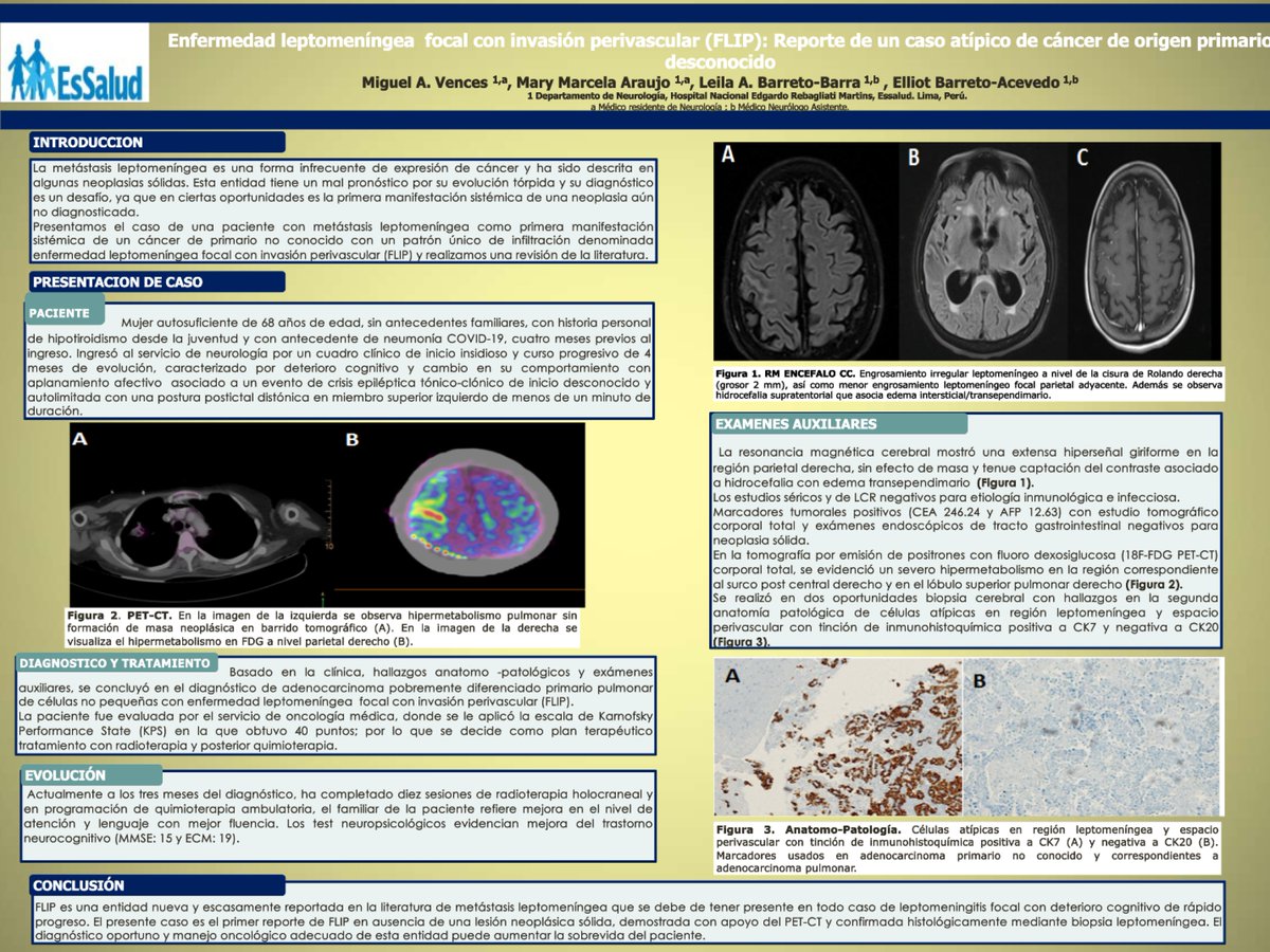 En esta oportunidad te presentamos el caso de una paciente con metástasis leptomeníngea. 👩‍⚕️👨‍⚕️
spneurologia.org.pe
Escríbenos al correo:
sociedadperuananeurologiaspn@hotmail.com🧠👨‍⚕️👩‍⚕️
#Medicina #Neurology #Doctores #Enfermeras
