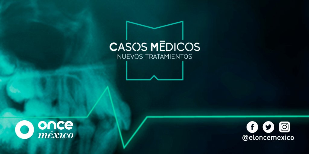 ElOnceMexico's tweet photo. Gracias a la #microinfusora de insulina, los pacientes diabéticos pueden reducir considerablemente el número de inyecciones que deben aplicarse cada día.
Conoce más en la serie «#CasosMédicos, nuevos tratamientos» hoy a las 16:00h Pacífico/19:00h Este.
#OnceMéxicoContigo https://t.co/jFsaQpmpON