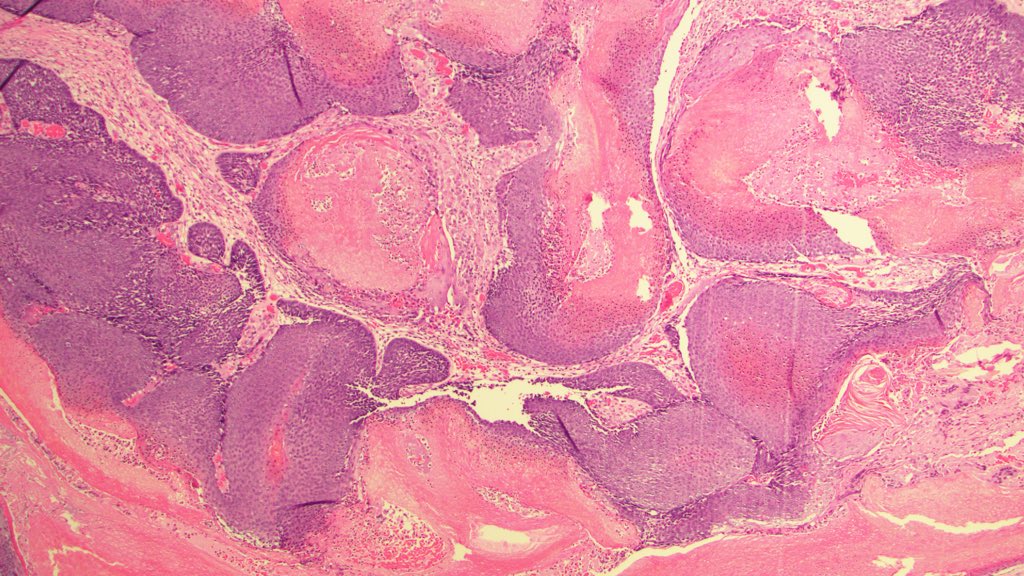 DermpatGal's tweet photo. Spot diagnosis of a true beauty! https://t.co/oIpcITMoVs