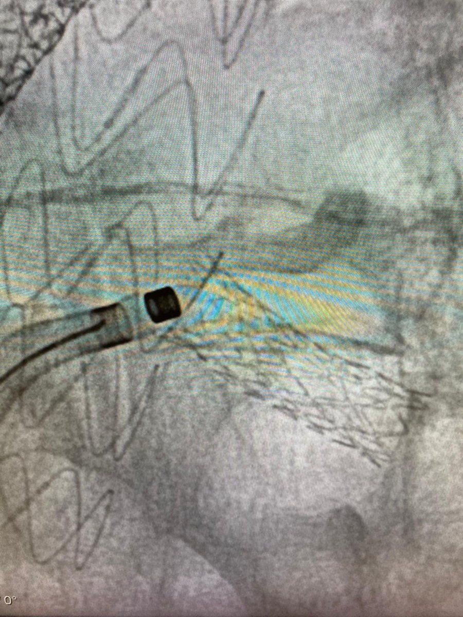 Uppsala Aortic Center tweet media