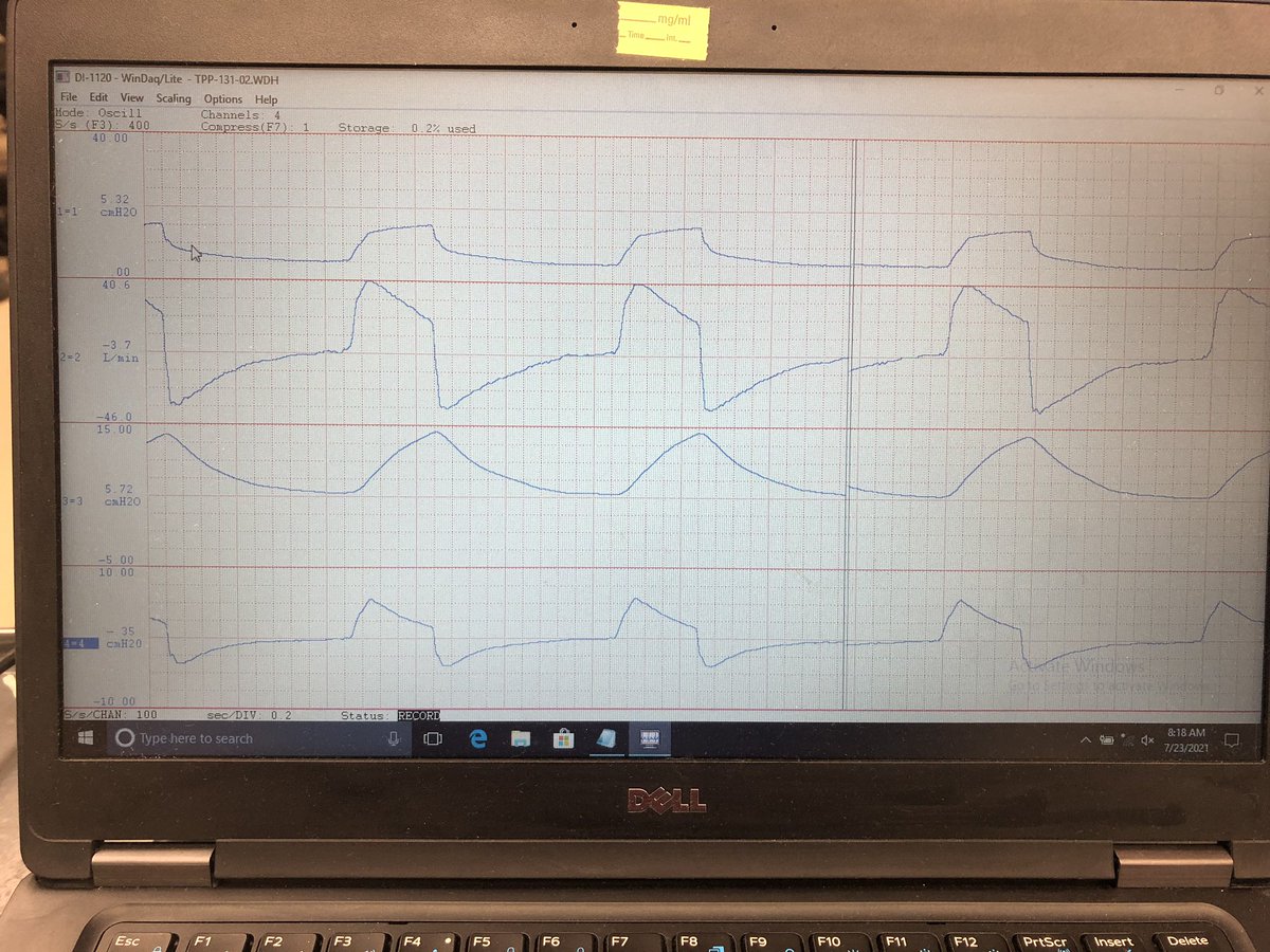 collindickrson's tweet photo. A summer studying pulmonary mechanics comes to a close here at UVM. Thanks to @FAERanesthesia for making it possible. Made some good friends along the way! https://t.co/Ebih7q565X