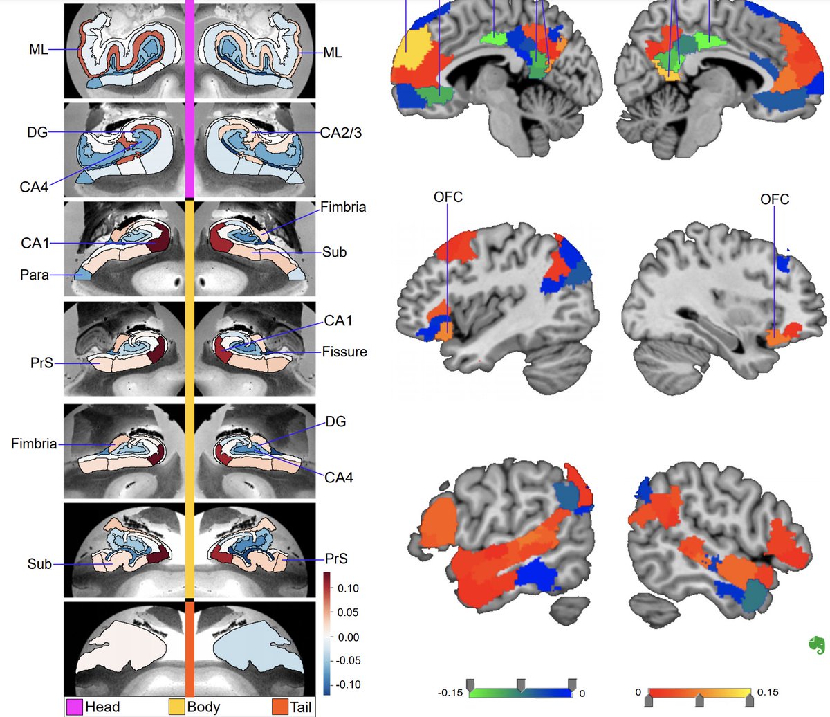 danilobzdok's tweet photo. Are you interested in how #hippocampus #subfields are inter-related with the #higher #association #cortex in humans?

Chris Zajner from our team makes steps in this direction in this new  @biorxiv_neursci preprint w/ @Nathan_Spreng.

https://t.co/t4jCKokhpz https://t.co/ObU2tUmqkR