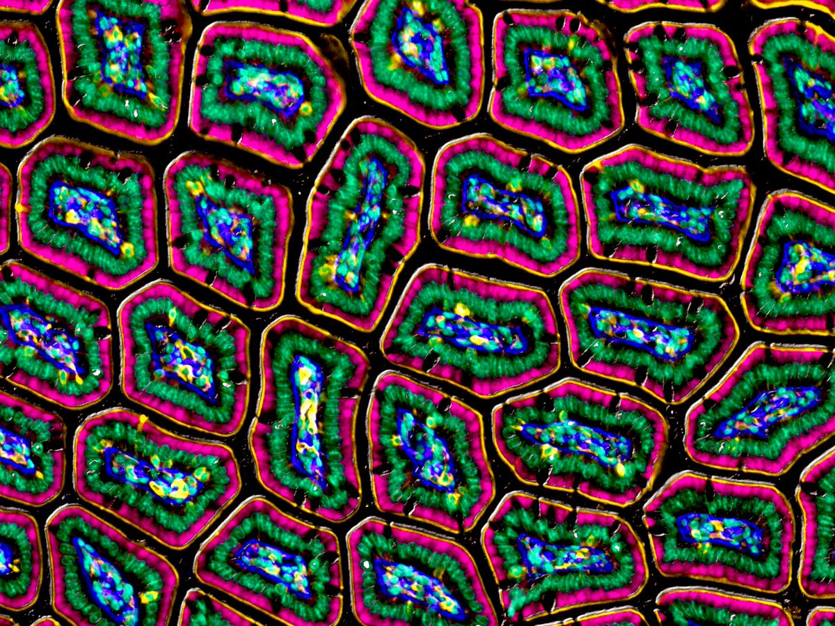 #FluorescenceFriday I love the organization of the small intestine. Laminin is blue, gamma actin is yellow, lamp1 in pink and nuclei are green 🔬 #microscopy #bioart #sciart