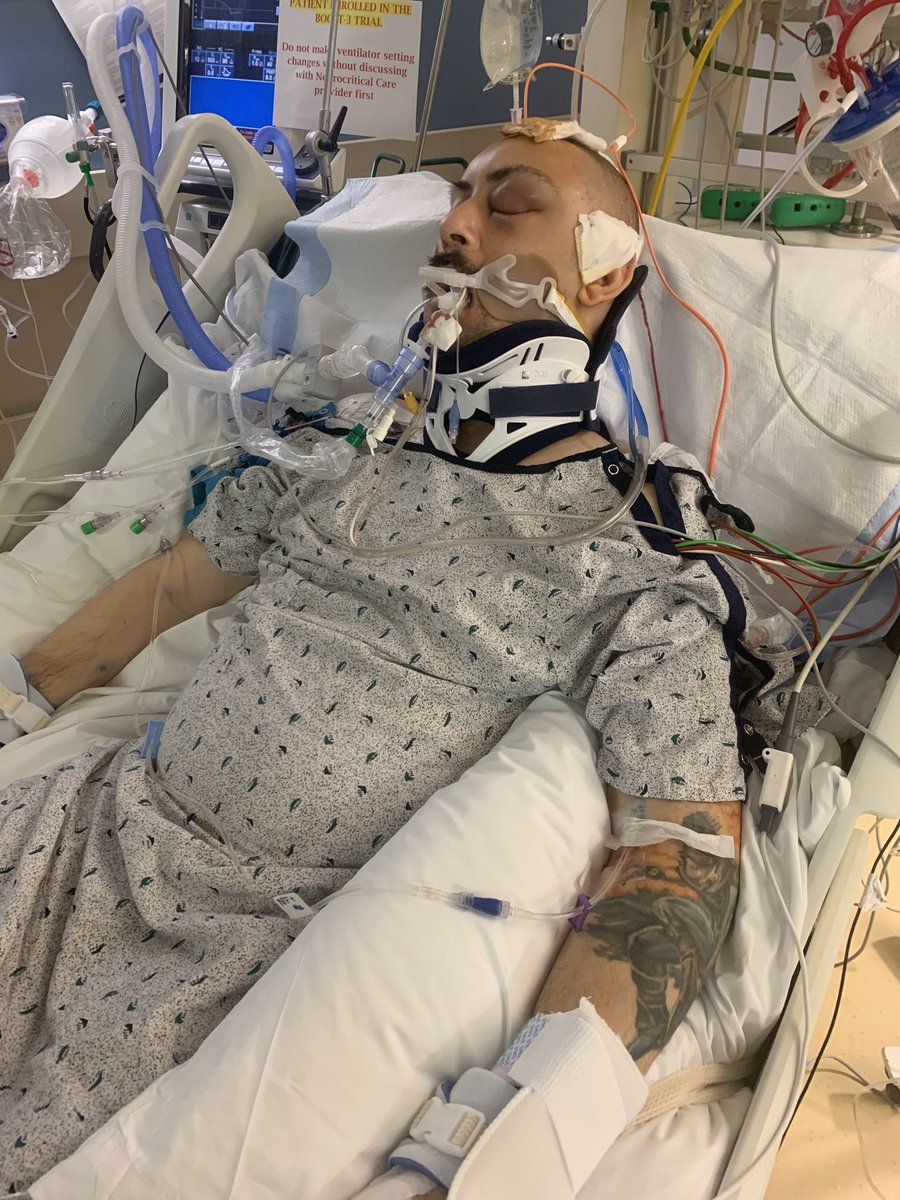 This is Zachary Lean. He was delivering groceries near 3rd &amp; Christian Tuesday around 10pm for ⁦<a href="/Shipt/">Shipt</a>⁩, when police say a group of teens on bikes sucker-punched him. He fell to the ground seizing &amp; is now in a coma, fighting for his life. His family is begging for answers.