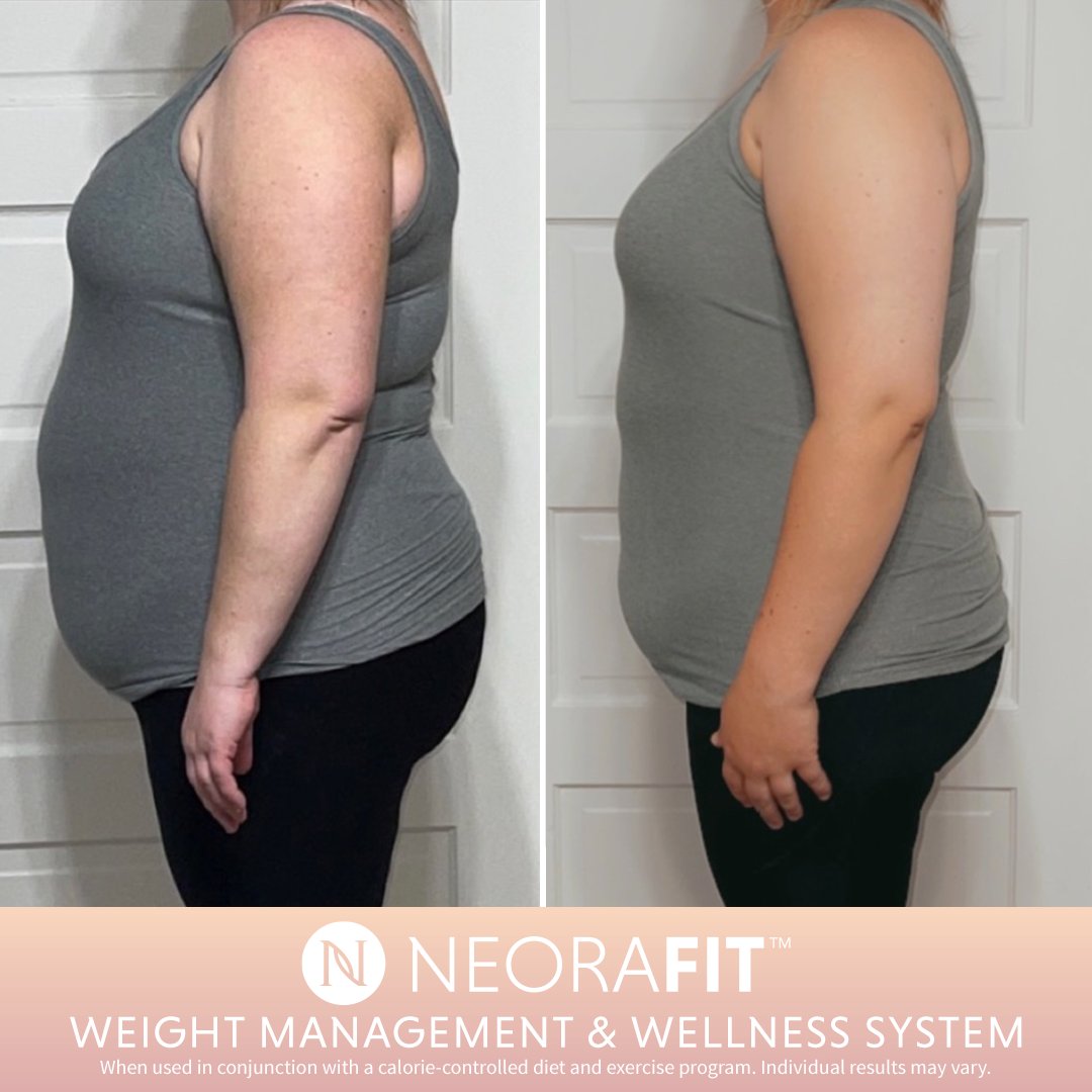 NeoraOfficial's tweet photo. As we all gave 2020 a big wave goodbye 👋 Neora went into the New Year with a brand new line the world really needed: a wellness system that worked! Our NeoraFit Weight Management & Wellness System took off 🚀 and became our best-selling set of 2021!
#10yearsofNeora https://t.co/ceho7tlx3t