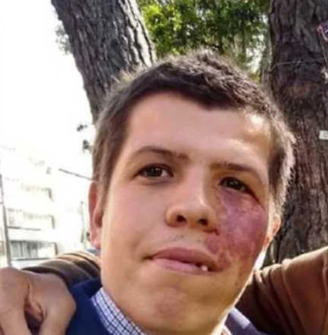 angelaSamNg's tweet photo. Lo amenazaron de muerte, y lo atacaron por su condición física, SI! Los mismos que dicen buscar una Colombia más Humana! https://t.co/KIvzn0PTwP