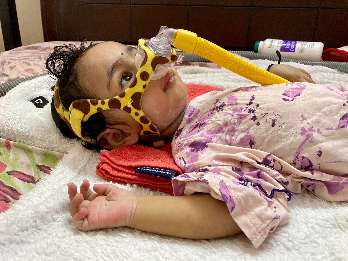 Update: Khyati’s throat muscles are shrinking day by day. She is having troubles even to swallow liquid food also. While having milk, it is getting accumulated in the throat, making her to choke.

Plz help her to get Zolgensma soon.
Donate: bit.ly/savekhyati

#savekhyati