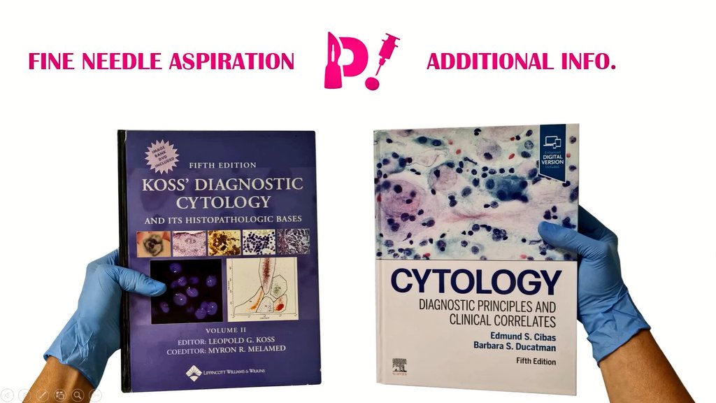 edusqo's tweet image. - Vous avez des références, Monsieur?
- Bien sûr que j&apos;ai des références: earth wind &amp;amp; fire, kool &amp;amp; the gang...
Intouchables, with @OmarSy.
Well, these are some of the #SimInPath workshop ones 😄.
What do you think about them, tweeples?
#ILookLikeAPathologist #MedEd
#Pathology