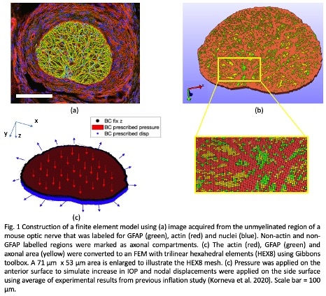 New conf. paper featuring GIBBON: 

Ling et al. "Computational Model of the Stress and Deformation Response of the Mouse Astrocytic Lamina to Intraocular Pressure"

iovs.arvojournals.org/article.aspx?a…

Thanks for using GIBBON, next time please cite GIBBON: doi.org/10.21105/joss.…