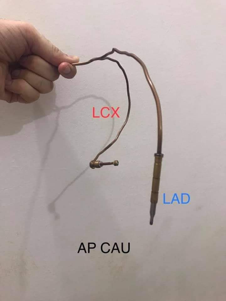 fazalabul's tweet image. Angiographic views of left coronary arteries
