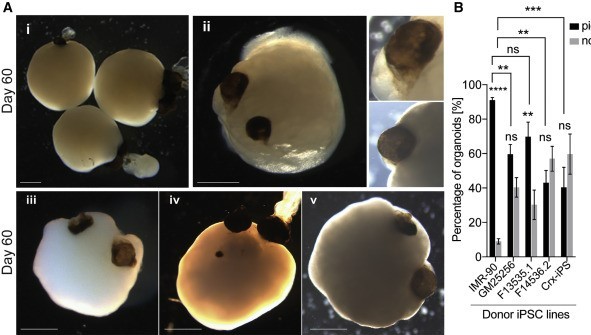 STEMCELLTech's tweet photo. Dr. Gopalakrishnan's lab (@Jayslab2) at @HHU_de discovered that 30 day old brain #organoids began developing optic vesicles that were light sensitive and included primitive corneal epithelial and lens-like cells. 🧠👀 https://t.co/P7nPdPvsVL https://t.co/QyAyrbvBPy
