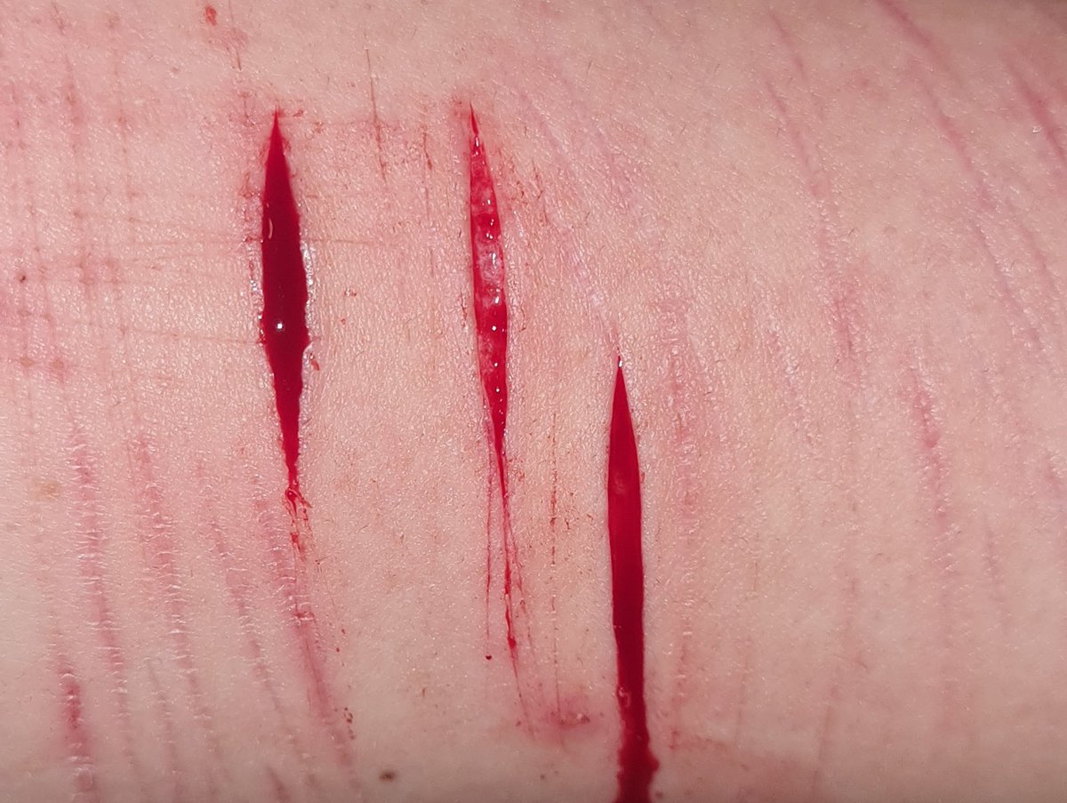 coreycantspeak2's tweet photo. tw self harm, blood etc
-
-
-
-
-
-
-
mwuah so hot https://t.co/XCQz9TYCNK