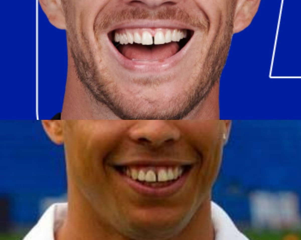 sobattoxic's tweet photo. @Inter @EdDzeko You know the player is good when they have this teeth 🔥🔥🔥 https://t.co/vN2fQiO56n