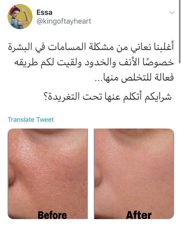 الأبيض tweet media