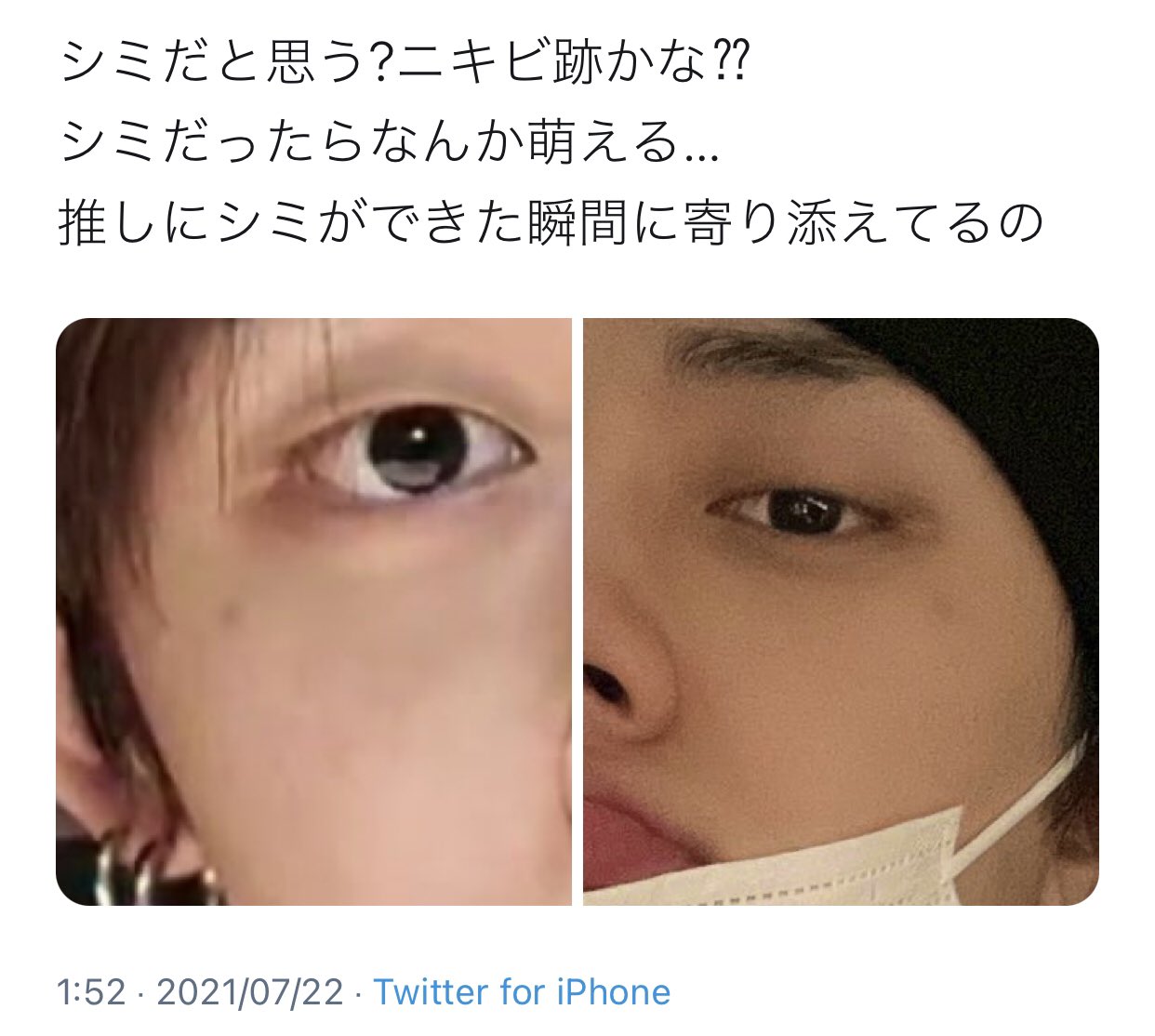 Shii 마나 中華ヨントンでヨンジュンの눈물점の謎が解明されたㅠㅠ 予想 ほくろできた 除去傷跡できた 撮影時期にはあったから書いてる だと思ってたけど 事実 傷できた 傷跡によって黒点 ホクロ できる いまある だったみたい だから