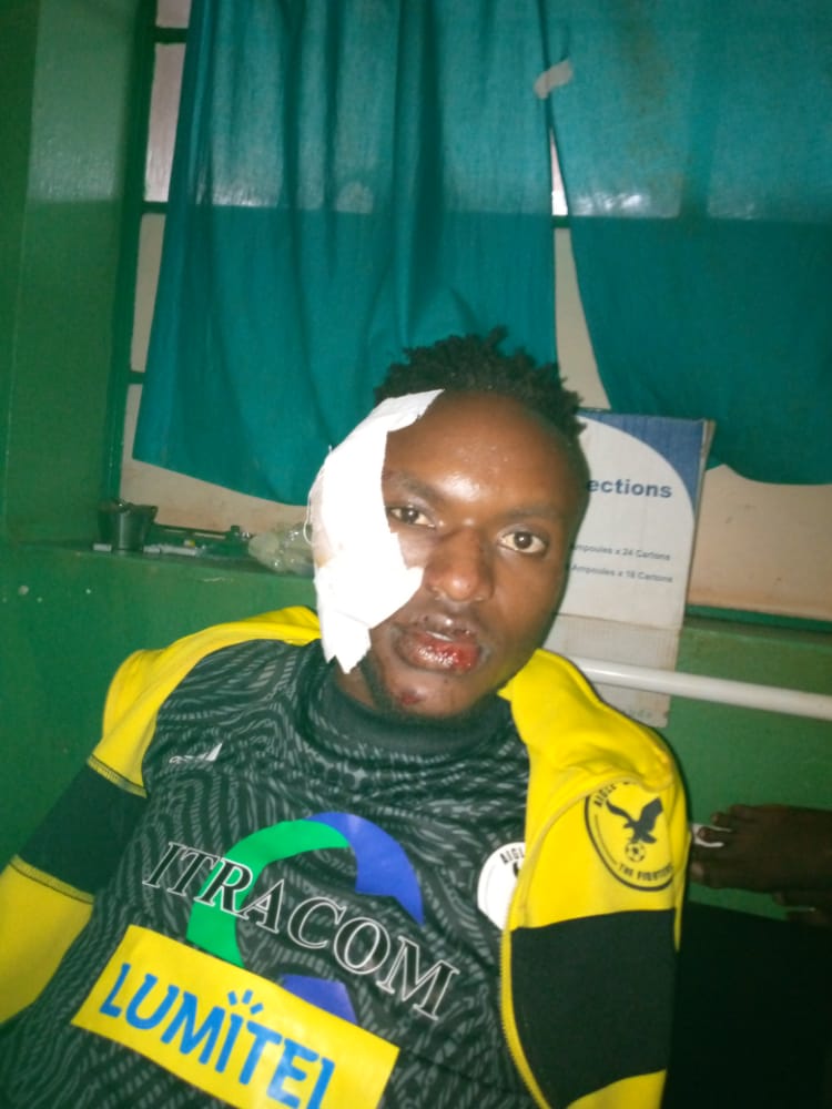 257Foot's tweet photo. #SadNews 🇧🇮
@aiglenoircs players was involved in an accident while they were on their way to #Kayanza ahead of their clash between #Top_Junior on Burundi Primus League #Matchday3.
No death registered but many players are badly hurted. https://t.co/CtudwCuNFE