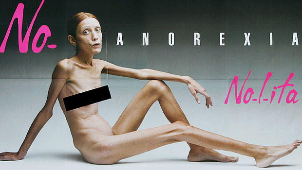 ⭐️拒食症の危険性を訴えるためにヌード姿を披露したイザベル・カロさん。イタリアの拒食症啓発キャンペーンより

165cmで体重はわずか32kg

痩せすぎたモデルに憧れてしまい健康被害がでていて、規制策やブランドの方向性が見直されるなど、世界的な動きが続いている 