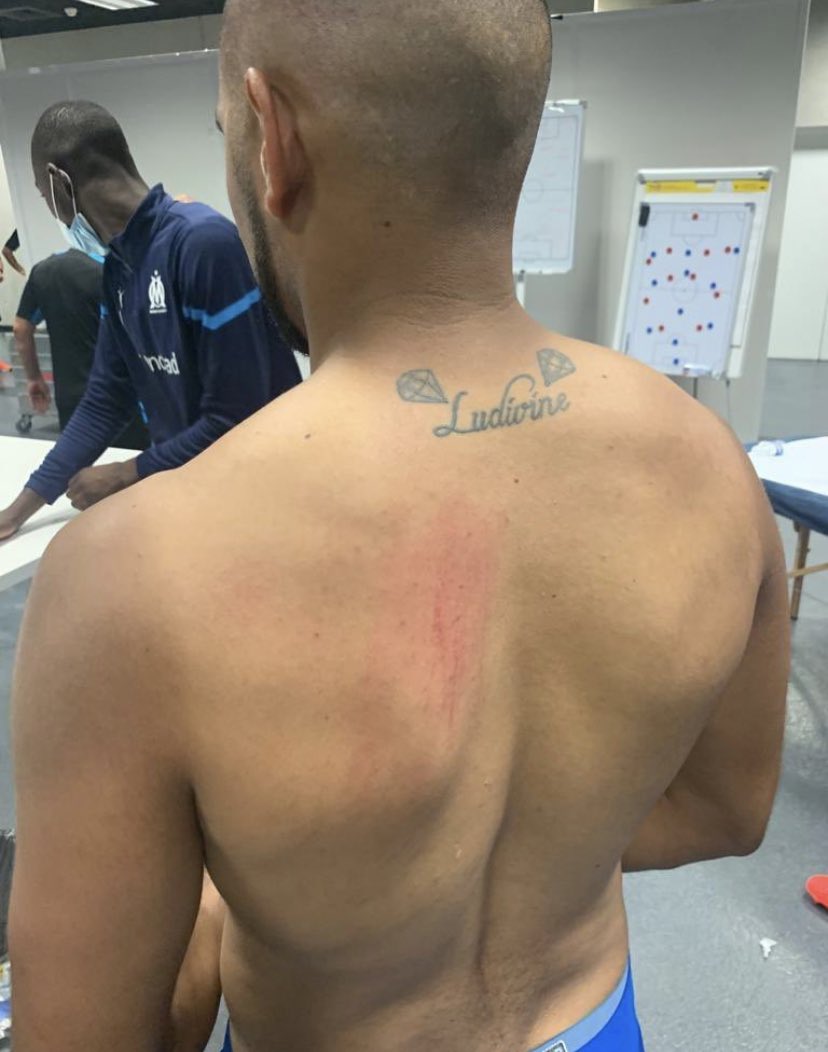 infoom_13's tweet photo. "La situation n'est pas suffisante pour justifier un arrêt complet du match" selon le corps arbitral
#TeamOM #OGCNOM https://t.co/RDwH03acG5