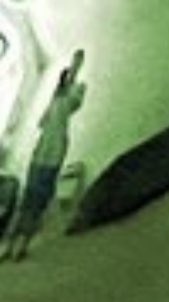 FanLemickey's tweet photo. @Folesylvania @GMFTommyx2 Found you.I have a question.why is yourr back like that. Sever scoliosis. Ahhhhhh https://t.co/USCP85dqer