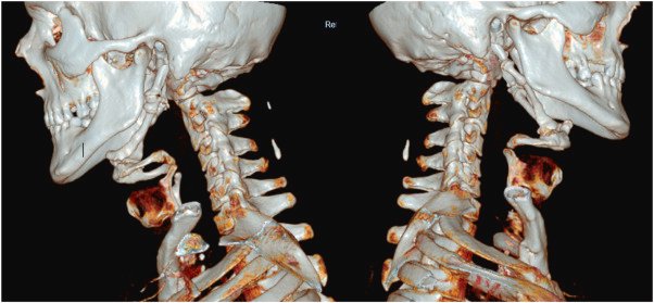 Otolaryngology Cases tweet media
