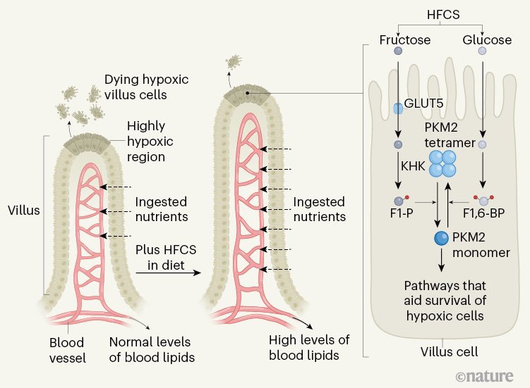 john_damianosMD's tweet photo. How do processed sugars lead to weight gain? 

🍭🍰🥤🍦🧁🍩🥓🥩🧀🍖🍔🧈

Novel mechanism: High fructose corn syrup elongates villi, enhancing the absorption of fats. 

#medicine #science #obesity #health #diet #nutrition #GITwitter #GI #gut 

https://t.co/yoLjAloV3r https://t.co/tkxyDKeg7F